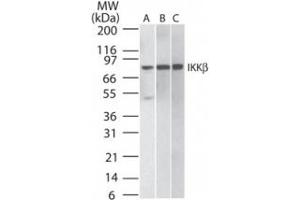 Image no. 1 for anti-Inhibitor of kappa Light Polypeptide Gene Enhancer in B-Cells, Kinase beta (IKBKB) antibody (ABIN208069) (IKBKB anticorps)