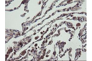 Image no. 15 for anti-Ubiquitin-Conjugating Enzyme E2, J1, U (UBE2J1) antibody (ABIN1501637)