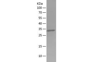 Western Blotting (WB) image for S100 Calcium Binding Protein B (S100B) (AA 1-92) protein (His-IF2DI Tag) (ABIN7124973)