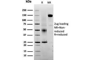 SDS-PAGE Analysis Purified PAI-RBP1 Mouse Monoclonal Antibody (SERBP1/3493).
