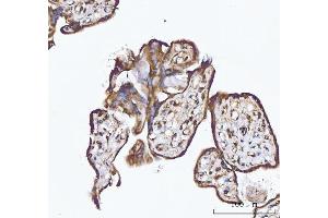 IHC analysis of XAF1 using anti-XAF1 antibody (ABIN7600450).