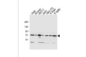 All lanes : Anti-MTA1 Antibody (C-term) at 1:1000 dilution Lane 1: Hela whole cell lysate Lane 2: mouse brain lysate Lane 3: MCF-7 whole cell lysate Lane 4: A431 whole cell lysate Lane 5: NIH-3T3 whole cell lysate Lane 6: human brain lysate Lane 7: rat testis lysate Lysates/proteins at 20 μg per lane. (MTA1 anticorps  (C-Term))