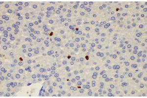 Immunohistochemistry of paraffin-embedded Rat liver using S100a8 Polycloanl Antibody at dilution of 1:200 (S100A8 anticorps)
