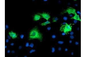 Anti-KATNB1 mouse monoclonal antibody (ABIN2455151) immunofluorescent staining of COS7 cells transiently transfected by pCMV6-ENTRY KATNB1 (RC201852). (KATNB1 anticorps)