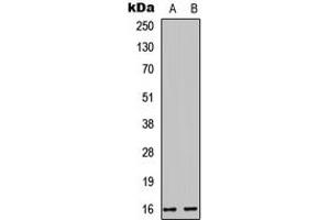 Western blot analysis of Cystatin E/M expression in HEK293T (A), PC12 (B) whole cell lysates. (CST6 anticorps  (Center))