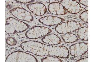 anti-Calcium and Integrin-Binding Protein 1 (CIB1) (AA 1-192) antibody
