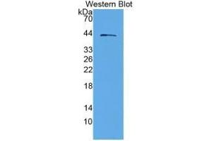 SDS-PAGE of Protein Standard from the Kit (Highly purified E. (IGFBPI Kit CLIA)