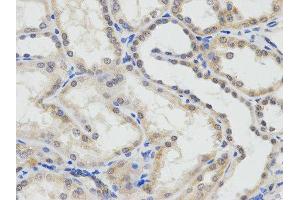 Immunohistochemistry (IHC) image for anti-Excision Repair Cross Complementing Polypeptide-1 (ERCC1) antibody (ABIN1876479) (ERCC1 anticorps)