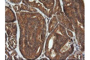 Image no. 1 for anti-Cyclin-Dependent Kinase Inhibitor 2B (p15, Inhibits CDK4) (CDKN2B) antibody (ABIN1497447)