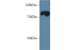 Western Blot; Sample: Mouse Skeletal muscle lysate; Primary Ab: 1µg/ml Rabbit Anti-Rat TRDN Antibody Second Ab: 0. (Triadin anticorps  (AA 486-687))