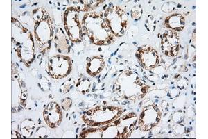 Immunohistochemical staining of paraffin-embedded Human Kidney tissue using anti-IGF2BP2 mouse monoclonal antibody. (IGF2BP2 anticorps)