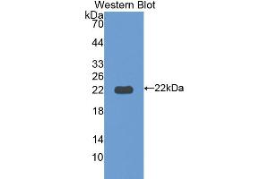 Western blot analysis of the recombinant protein. (ITLN1/Omentin anticorps  (AA 101-292))
