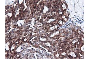 Image no. 3 for anti-F-Box Protein 21 (FBXO21) antibody (ABIN1498231) (FBXO21 anticorps)