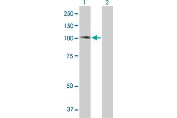 ATM Interactor antibody  (AA 1-667)