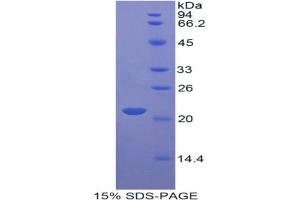 SDS-PAGE analysis of Rat Apolipoprotein D Protein. (Apolipoprotein D Protein (APOD))