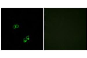 Immunofluorescence analysis of MCF-7 cells, using MC5R antibody. (MC5 Receptor anticorps  (C-Term))