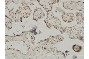 Immunoperoxidase of monoclonal antibody to ETV6 on formalin-fixed paraffin-embedded human placenta.