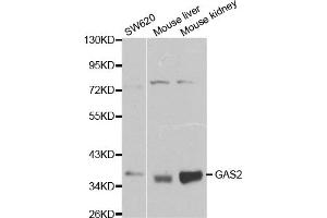 Western blot analysis of extracts of various cell lines, using GAS2 antibody (ABIN5970514) at 1/1000 dilution.