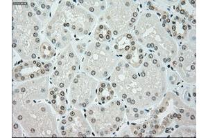 Image no. 8 for anti-Checkpoint Kinase 2 (CHEK2) antibody (ABIN1497496)