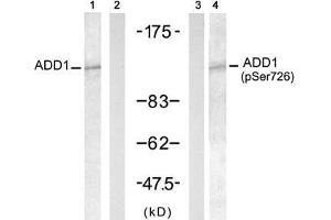 Western blot analysis of extract from HT-29 cells untreated or treated with Doxorubicin (1mM, 30min), using ADD1 (Ab-726) antibody (E021189, Lane 1 and 2) and ADD1 (Phospho- Ser726) antibody (E011182, Lane 3 and 4). (alpha Adducin anticorps  (pSer726))