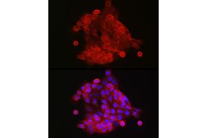 Immunofluorescence analysis of  cells using S100 Rabbit pAb (842) at dilution of 1:150 (40x lens).