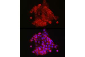 Immunofluorescence analysis of  cells using S100 Rabbit pAb (842) at dilution of 1:150 (40x lens). (S100A9 anticorps  (AA 1-114))