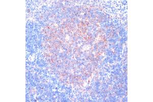 Immunohistochemistry of paraffin-embedded mouse spleen using RPL31 antibody (ABIN7270002) at dilution of 1:100 (40x lens). (RPL31 anticorps  (AA 5-105))