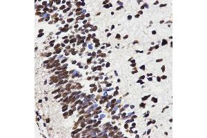Immunohistochemistry (IHC) image for anti-High Mobility Group Box 1 (HMGB1) (AA 100-200) antibody (ABIN3023358) (HMGB1 anticorps  (AA 100-200))