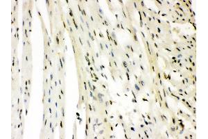 Anti- SLUG Picoband antibody,IHC(P) IHC(P): Rat Cardiac Muscle Tissue