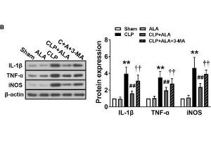 Effects of ALA on cardiac function, inflammation and autophagy in CLP-induced septic rats.