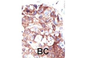 Immunohistochemistry (IHC) image for anti-Ubiquilin 1 (UBQLN1) antibody (ABIN3001493) (Ubiquilin 1 anticorps)