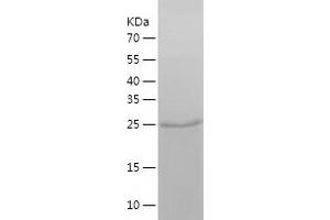 Western Blotting (WB) image for N-Myc Proto-Oncogene Protein (MYCN) (AA 282-464) protein (His tag) (ABIN7124095)