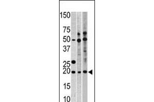 Western blot analysis of anti-RPL23A Pab in, from left to right, CEM, Hela, and HepG2 cell line lysates (35ug/lane)