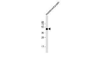 Anti-FAT1 Antibody at 1:2000 dilution + recombinant protein Lysates/proteins at 20 μg per lane. (FAT1 anticorps  (AA 4203-4539))