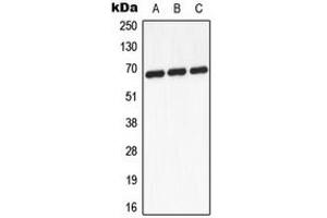 Western blot analysis of GCKR expression in A431 (A), mouse heart (B), PC12 (C) whole cell lysates. (GCKR anticorps  (Center))