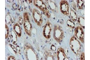 Immunohistochemical staining of paraffin-embedded Human Kidney tissue using anti-SAT2 mouse monoclonal antibody. (SAT2 anticorps)