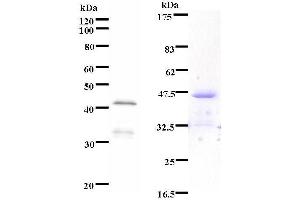 Left: RUNX3 staining. (TFEB anticorps)
