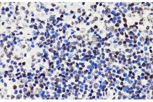 Immunohistochemistry of paraffin-embedded Rat spleen using Acetyl-Histone H2B-K5 Polyclonal Antibody at dilution of 1:100 (40x lens). (Histone H2B anticorps  (acLys5))