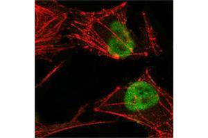 Confocal immunofluorescence analysis of Hela cells using MSH2 mouse mAb (green), showing nuclear localization.