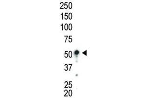 Western blot analysis of AMPK antibody and mouse liver lysate