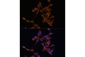 Immunofluorescence analysis of HeLa cells using UBE2J1 antibody (ABIN7271172) at dilution of 1:100.