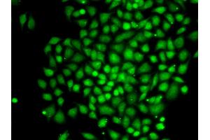 Immunofluorescence (IF) image for anti-CCCTC-Binding Factor (Zinc Finger Protein)-Like (CTCFL) antibody (ABIN1877135) (CTCFL anticorps)