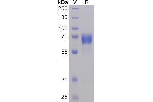Human NTB-A Protein, mFc-His Tag on SDS-PAGE under reducing condition.