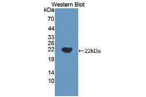 Detection of Recombinant IL18, Porcine using Polyclonal Antibody to Interleukin 18 (IL18) (IL-18 anticorps  (AA 36-192))