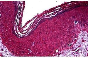Human Skin: Formalin-Fixed, Paraffin-Embedded (FFPE)