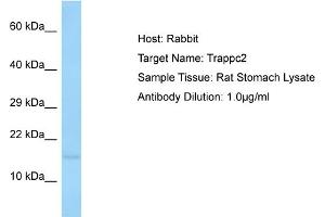 Host: Rabbit Target Name: TRAPPC2 Sample Tissue: Rat Stomach Antibody Dilution: 1ug/ml (TRAPPC2 anticorps  (N-Term))