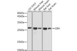 Western blot analysis of extracts of various cell lines, using CRH antibody (ABIN3021479, ABIN3021480, ABIN3021481 and ABIN6215115) at 1:1000 dilution. (CRH anticorps  (AA 25-194))