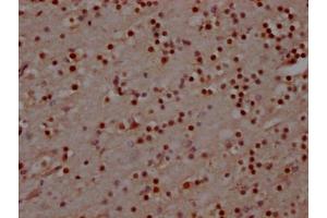 IHC image of ABIN7127607 diluted at 1:100 and staining in paraffin-embedded human brain tissue performed on a Leica BondTM system. (Recombinant MAD2L2 anticorps)