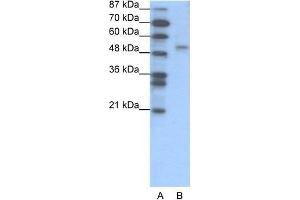 Human Jurkat; WB Suggested Anti-FOXD2 Antibody Titration: 1. (FOXD2 anticorps  (N-Term))
