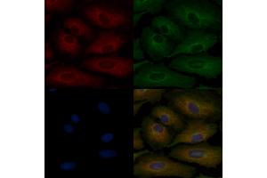 ABIN6263346 and ABIN6266864 staining  cells by IF/ICC.